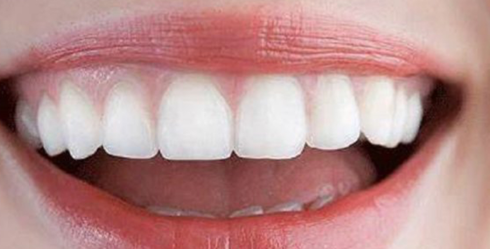 جين نادر” مسؤول عن شكل وحجم الأسنان؟