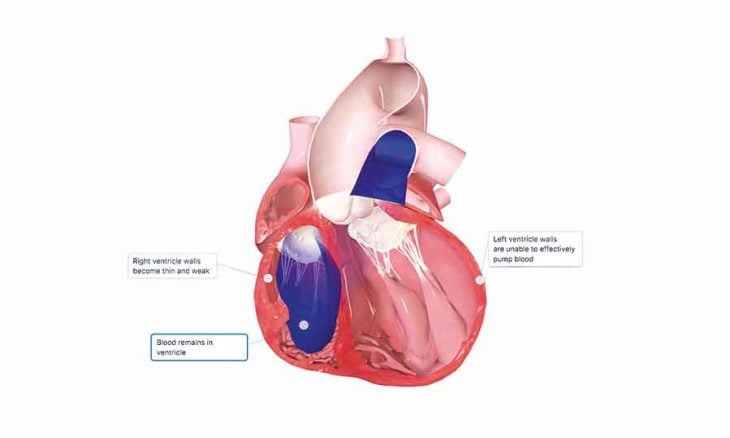 ابتكار قلب ثلاثي الأبعاد قد يُشكل طفرة علاجية غير مسبوقة