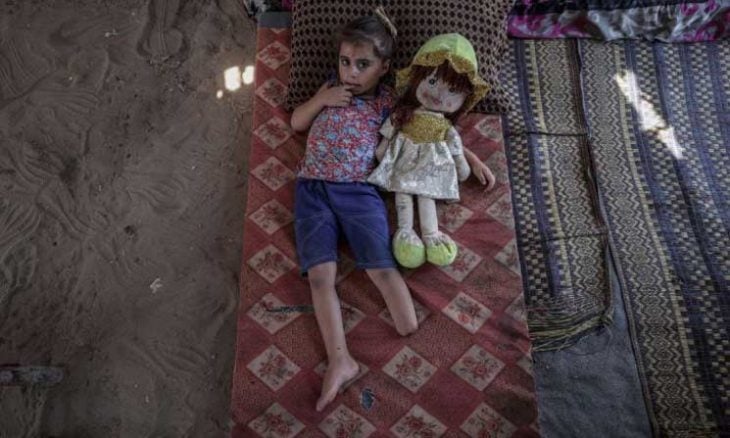 صحة غزة: 5 آلاف حالة بتر و10 آلاف بحاجة لتأهيل طويل الأمد